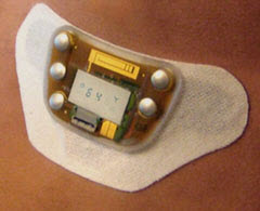 wearable glucose monitor